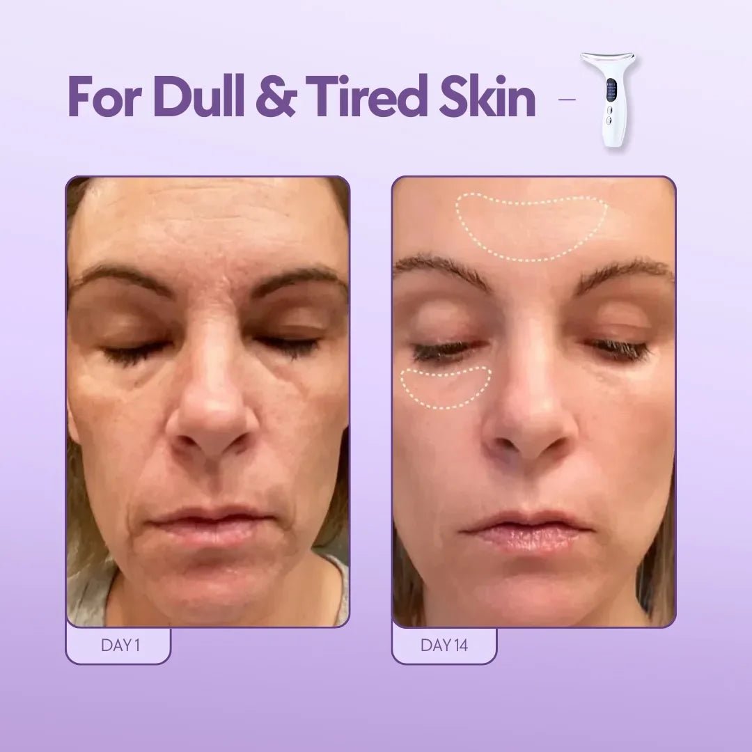 CitiISouq™️ 3 in 1 Face Lifting and Wrinkles Remover - CITI SOUQ